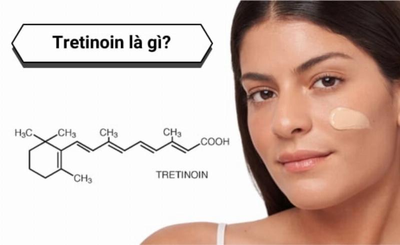 Hình ảnh minh họa một chu trình chăm sóc da dầu mụn hoàn chỉnh, với vị trí của toner.
