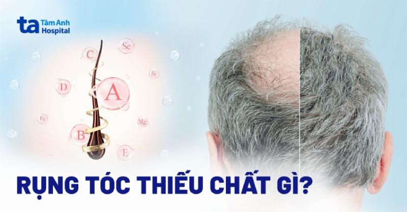 Hình ảnh một người đang thực hành thiền để giảm căng thẳng, giúp cải thiện sức khỏe tổng thể và giảm rụng tóc