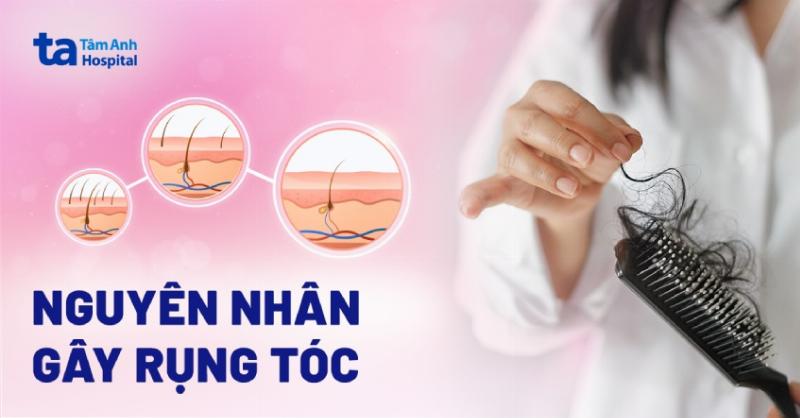Ảnh minh họa sự mất cân bằng nội tiết tố gây rụng tóc nhiều và ảnh hưởng đến sức khỏe tóc