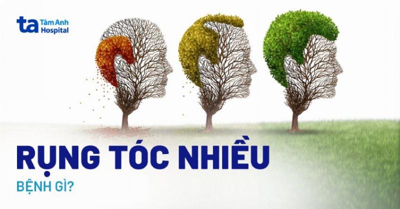 Hình ảnh minh họa dấu hiệu rụng tóc nhiều trên lược và sàn nhà, nhận biết sớm để xử lý kịp thời