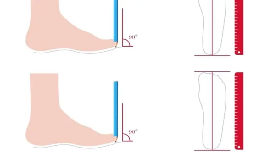 Đo đạc khoảng cách trục chiều dài và chiều rộng